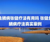 鱼鳞病张健疗法有用吗 张健鱼鳞病疗法真实案例