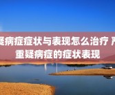 疑病症症状与表现怎么治疗 严重疑病症的症状表现