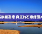 石崇巨富痣 真正的石崇痣图片 