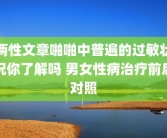 两性文章啪啪中普遍的过敏状况你了解吗 男女性病治疗前后对照