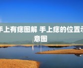 手上有痣图解 手上痣的位置示意图 